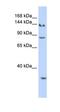 SIN3 Transcription Regulator Family Member A antibody, orb329662, Biorbyt, Western Blot image 