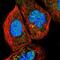 Poly(ADP-Ribose) Polymerase Family Member 10 antibody, NBP1-83689, Novus Biologicals, Immunocytochemistry image 