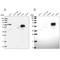 Acyl-CoA Synthetase Short Chain Family Member 3 antibody, NBP2-30585, Novus Biologicals, Western Blot image 