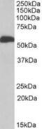 Aldehyde Dehydrogenase 5 Family Member A1 antibody, NBP1-52100, Novus Biologicals, Western Blot image 