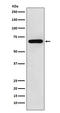 WASP Like Actin Nucleation Promoting Factor antibody, M05438, Boster Biological Technology, Western Blot image 