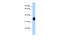 MAX Dimerization Protein MLX antibody, 29-165, ProSci, Western Blot image 