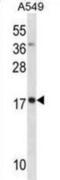 Myosin Light Chain 4 antibody, abx031027, Abbexa, Western Blot image 