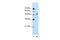 Ring Finger Protein 38 antibody, PA5-42335, Invitrogen Antibodies, Western Blot image 