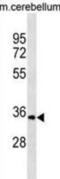 Uridine-Cytidine Kinase 1 antibody, abx030228, Abbexa, Western Blot image 