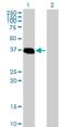 Zinc Finger Protein 444 antibody, H00055311-B01P, Novus Biologicals, Western Blot image 