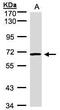 Activin A Receptor Like Type 1 antibody, GTX101921, GeneTex, Western Blot image 