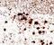 Glypican 3 antibody, orb389119, Biorbyt, Immunohistochemistry paraffin image 