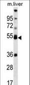 Peroxisome Proliferator Activated Receptor Alpha antibody, LS-C163888, Lifespan Biosciences, Western Blot image 
