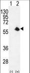 Cyclin-dependent kinase 8 antibody, LS-C168617, Lifespan Biosciences, Western Blot image 