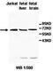 Poly(A) Binding Protein Cytoplasmic 3 antibody, orb77873, Biorbyt, Western Blot image 