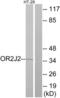 Olfactory Receptor Family 2 Subfamily J Member 2 antibody, LS-C120846, Lifespan Biosciences, Western Blot image 