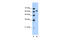 SPT16 Homolog, Facilitates Chromatin Remodeling Subunit antibody, 27-364, ProSci, Western Blot image 