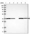 Zinc Finger And BTB Domain Containing 37 antibody, PA5-54799, Invitrogen Antibodies, Western Blot image 