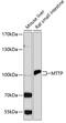 Microsomal Triglyceride Transfer Protein antibody, 16-950, ProSci, Western Blot image 