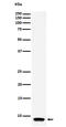 ATP synthase lipid-binding protein, mitochondrial antibody, M32382-1, Boster Biological Technology, Western Blot image 