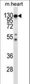 Colony Stimulating Factor 1 Receptor antibody, LS-C164350, Lifespan Biosciences, Western Blot image 