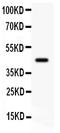 Activity Regulated Cytoskeleton Associated Protein antibody, PA1390, Boster Biological Technology, Western Blot image 