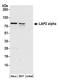 LAP2 antibody, A304-839A, Bethyl Labs, Western Blot image 