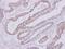 Hyaluronidase 1 antibody, NBP1-32465, Novus Biologicals, Immunohistochemistry frozen image 