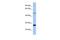 MIS12 Kinetochore Complex Component antibody, GTX44858, GeneTex, Western Blot image 