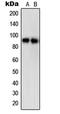 Signal Transducer And Activator Of Transcription 5A antibody, LS-C352887, Lifespan Biosciences, Western Blot image 