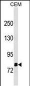 Olfactomedin Like 2B antibody, PA5-49242, Invitrogen Antibodies, Western Blot image 