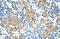 Toll-like receptor 6 antibody, ARP31755_P050, Aviva Systems Biology, Immunohistochemistry paraffin image 