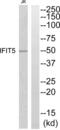 Interferon Induced Protein With Tetratricopeptide Repeats 5 antibody, abx015091, Abbexa, Western Blot image 