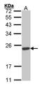 Suppressor Of Cytokine Signaling 1 antibody, PA5-27239, Invitrogen Antibodies, Western Blot image 