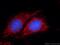 Ribosomal Protein S6 Kinase B1 antibody, 14485-1-AP, Proteintech Group, Immunofluorescence image 
