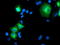 Proteasome 26S Subunit, Non-ATPase 2 antibody, TA503270, Origene, Immunofluorescence image 