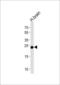 Glutathione S-Transferase Mu 5 antibody, LS-C166711, Lifespan Biosciences, Western Blot image 