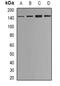 SET Domain Bifurcated Histone Lysine Methyltransferase 1 antibody, abx141816, Abbexa, Western Blot image 