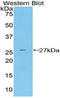 CYR61 antibody, LS-C293624, Lifespan Biosciences, Western Blot image 