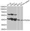 Proliferation-Associated 2G4 antibody, A14037, ABclonal Technology, Western Blot image 