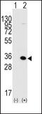 Methyl-CpG Binding Domain Protein 3 antibody, PA5-11168, Invitrogen Antibodies, Western Blot image 