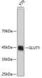 Solute Carrier Family 2 Member 1 antibody, 19-037, ProSci, Western Blot image 