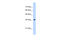 Alpha-1,4-N-Acetylglucosaminyltransferase antibody, 30-272, ProSci, Western Blot image 