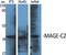 Melanoma-associated antigen C2 antibody, A05335, Boster Biological Technology, Western Blot image 