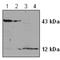 Caspase 2 antibody, GTX59706, GeneTex, Western Blot image 