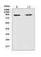 Toll Like Receptor 1 antibody, A00429-2, Boster Biological Technology, Western Blot image 