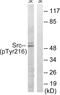 SRC Proto-Oncogene, Non-Receptor Tyrosine Kinase antibody, PA5-39766, Invitrogen Antibodies, Western Blot image 