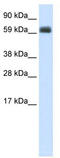 T-Box 21 antibody, TA329696, Origene, Western Blot image 