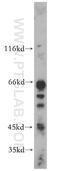 Fibronectin Type III And SPRY Domain Containing 1 Like antibody, 21032-1-AP, Proteintech Group, Western Blot image 