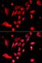 Cadherin 3 antibody, orb333718, Biorbyt, Immunocytochemistry image 