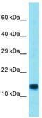 ATP11A Upstream Neighbor antibody, TA334908, Origene, Western Blot image 