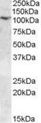 Transient Receptor Potential Cation Channel Subfamily C Member 6 antibody, PA5-18995, Invitrogen Antibodies, Western Blot image 