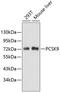 Proprotein Convertase Subtilisin/Kexin Type 9 antibody, 19-973, ProSci, Western Blot image 