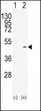 Alcohol Dehydrogenase 1C (Class I), Gamma Polypeptide antibody, LS-C156086, Lifespan Biosciences, Western Blot image 